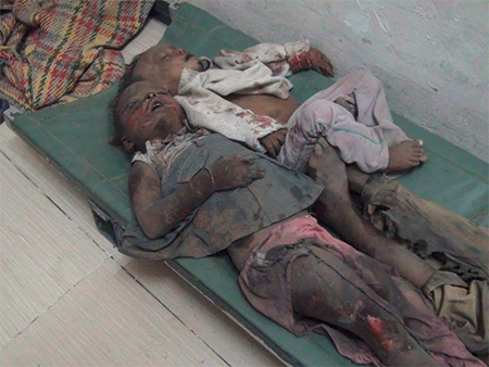 Particular preocupación por la situación en Yemen