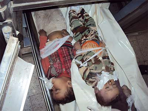 Imágenes de niños yemeníes cuentan la realidad de una ciega agresión