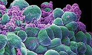 Científicos iraníes desarrollan un medicamento para combatir el cáncer
