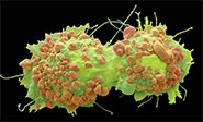 Cient&iacute;ficos est&aacute;n m&aacute;s cerca de la cura del c&aacute;ncer 