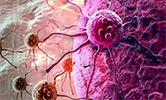 Descubren la forma de parar la propagaci&oacute;n del c&aacute;ncer