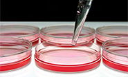 Descubren la prote&iacute;na responsable de la regeneraci&oacute;n del h&iacute;gado 