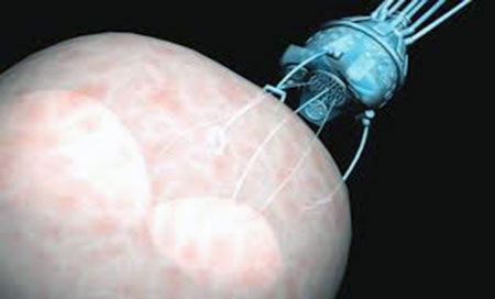 Microbots para luchar contra la ceguera